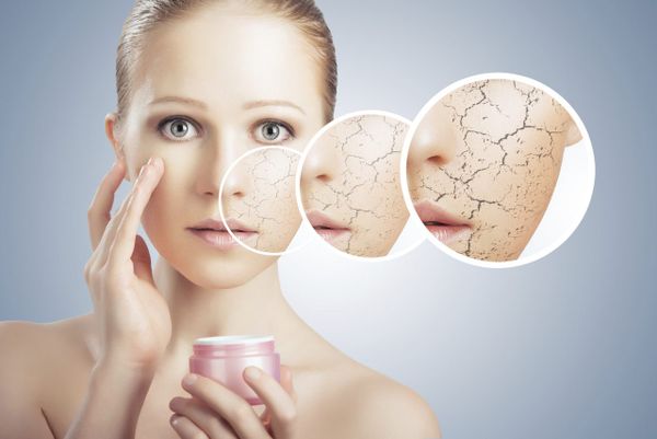 Mắc 1 trong 4 sai lầm này thì dù có dưỡng ẩm cho da bằng mỹ phẩm cao cấp cũng uổng phí
