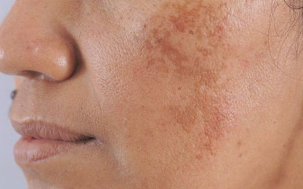 Lời khuyên quan trọng từ Chuyên gia Da Liễu Hàng Đầu Hoa Kỳ