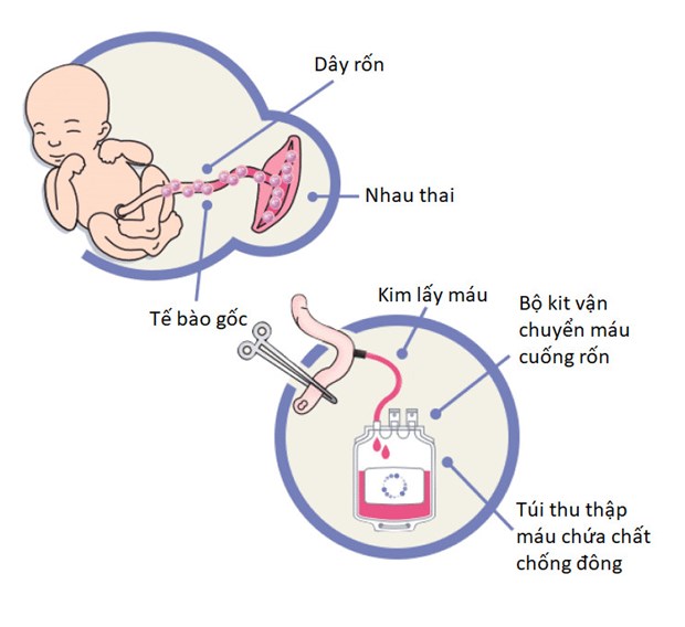 Quy trình lưu trữ tế bào gốc