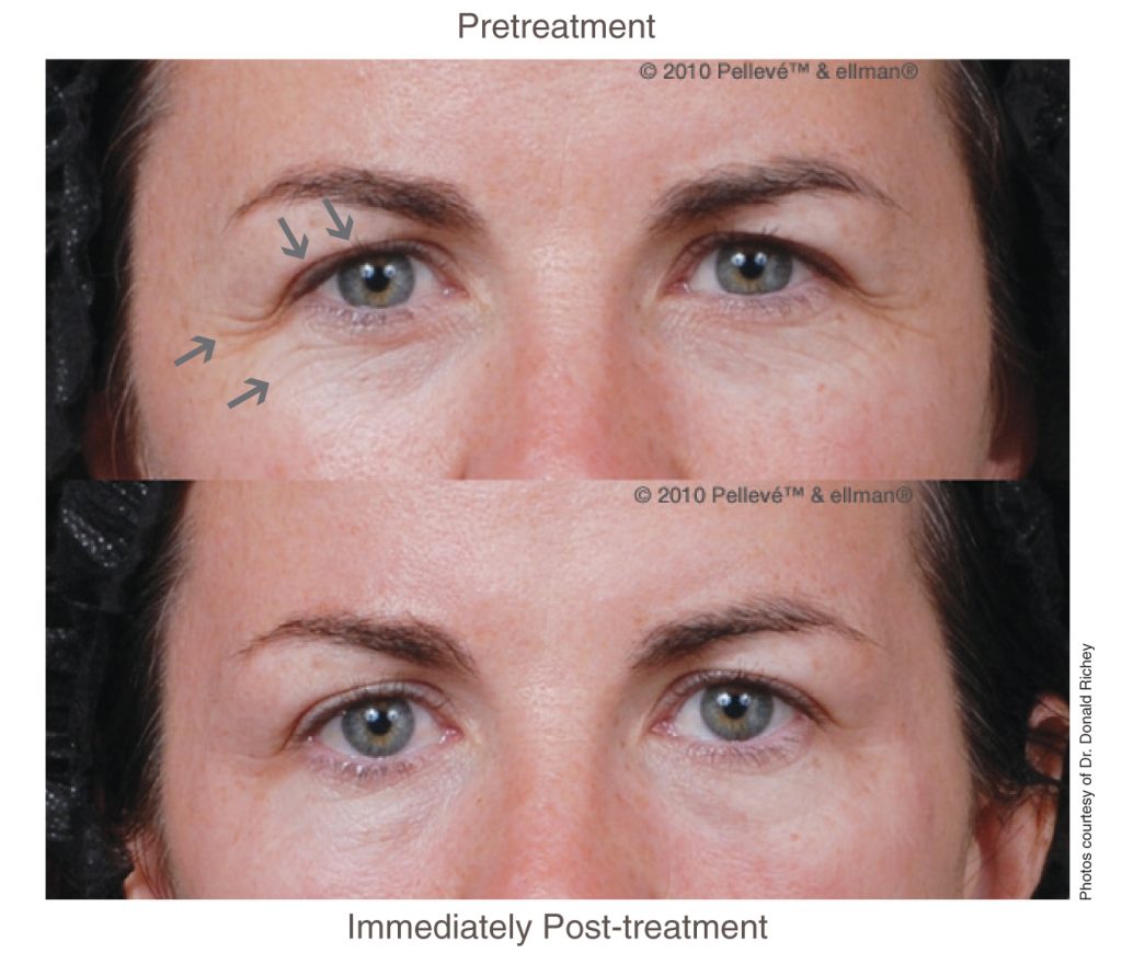 EYES Full Face photo by Dr. Don Richey