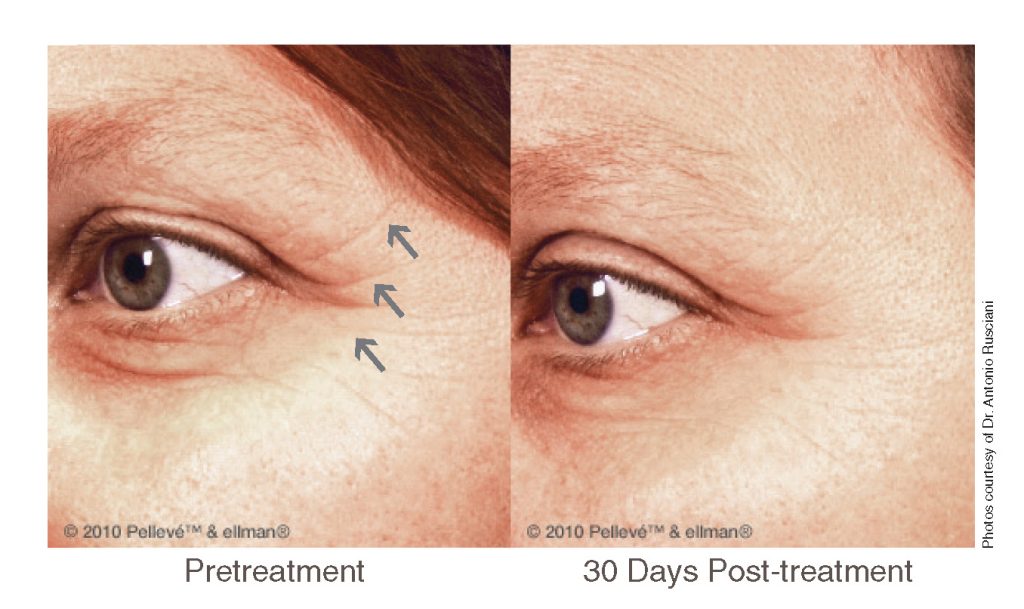 EYES photo by Dr. Antonio Rusciani