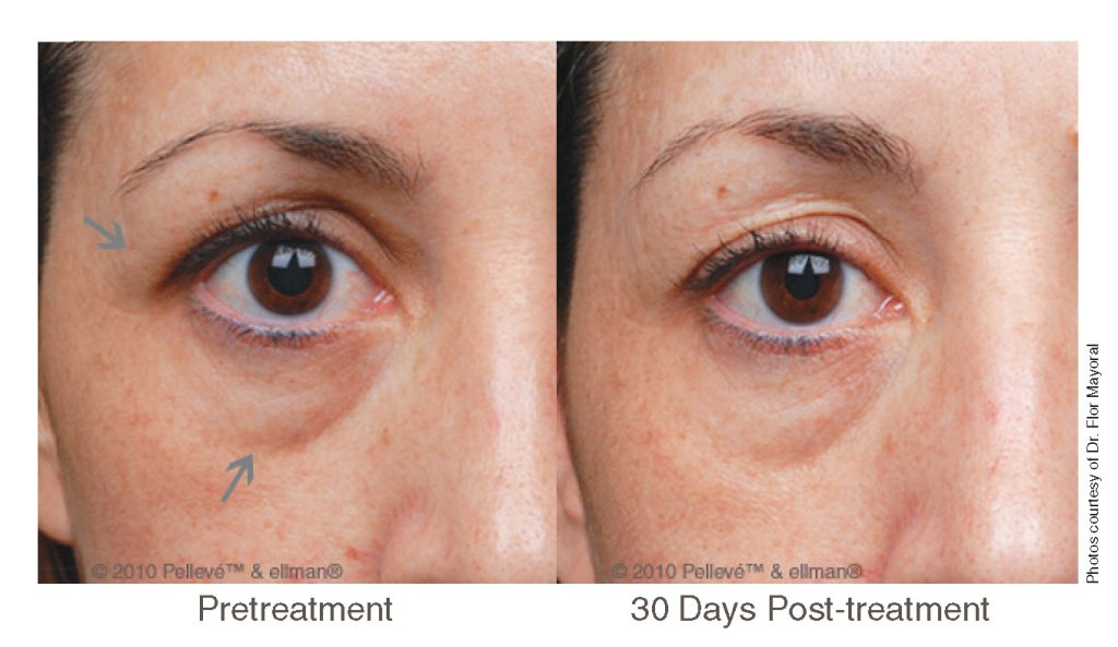 EYES photo by Dr. Flor Mayoral 1