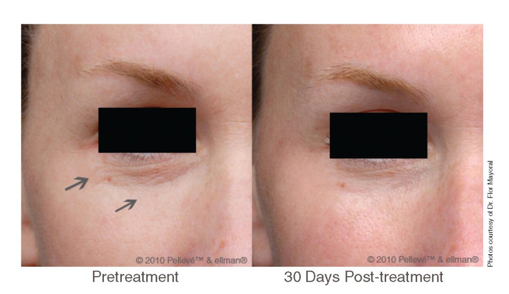 EYES photo by Dr. Flor Mayoral